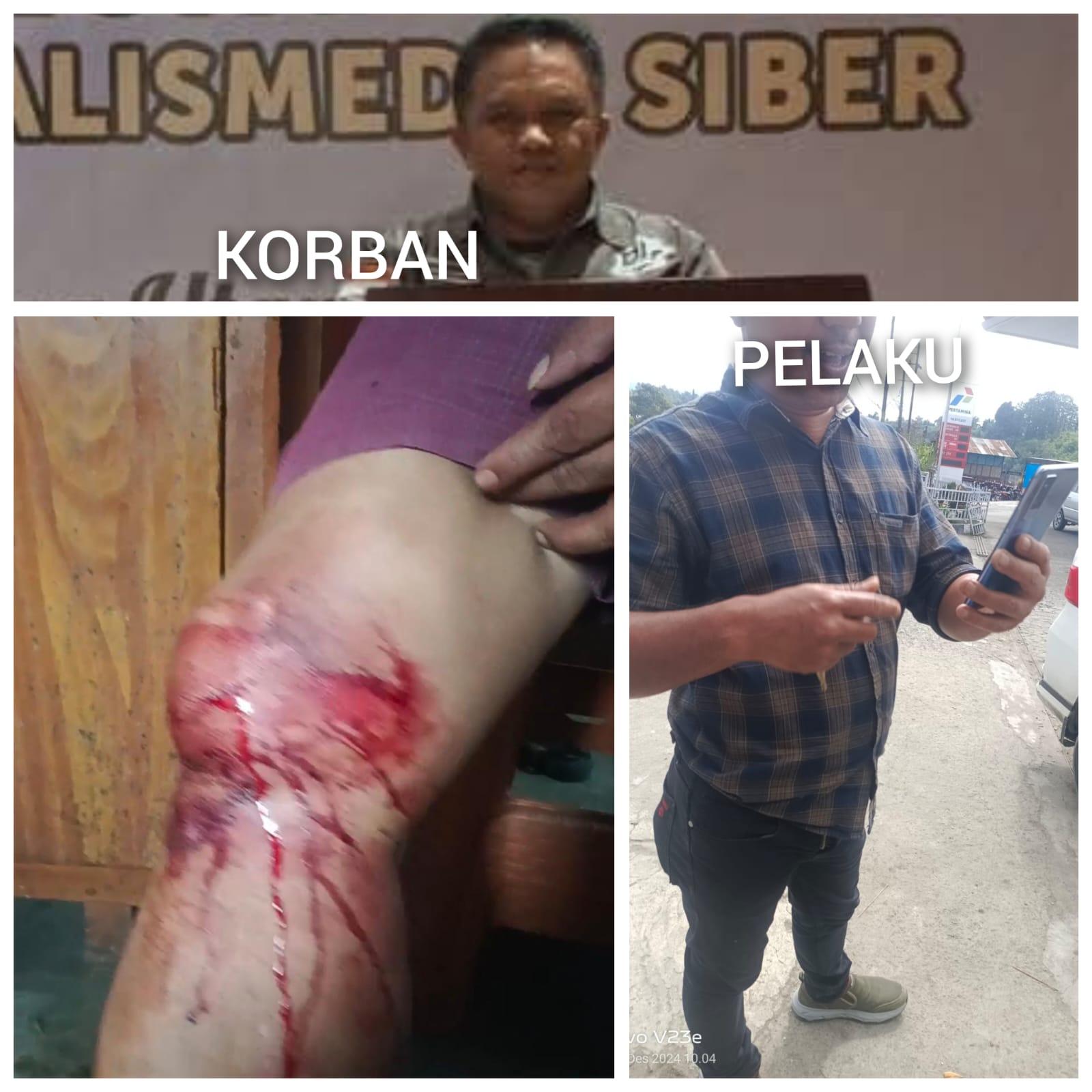 Seorang Staf Bidang Cipta Karya Dinas PUTR Kabupaten Karo “Menganiaya Penggiat LSM KCBI Kabupaten Karo Sampai Luka Parah