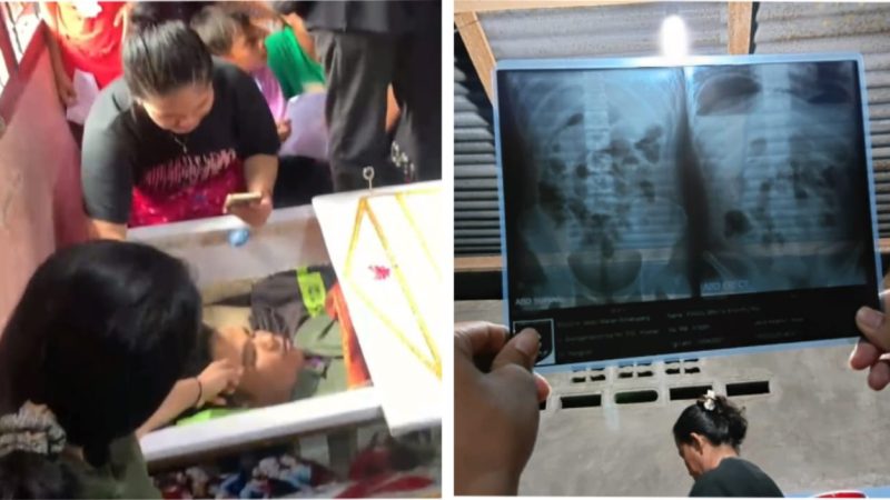 Letuskan Tembakan Saat Kejar Siswa Yang Kendarai Sepeda Motor Kambam 5 Hingga Korban Lompat dan Terjatuh Diduga Sempat Ditabrak Oknum Polisi