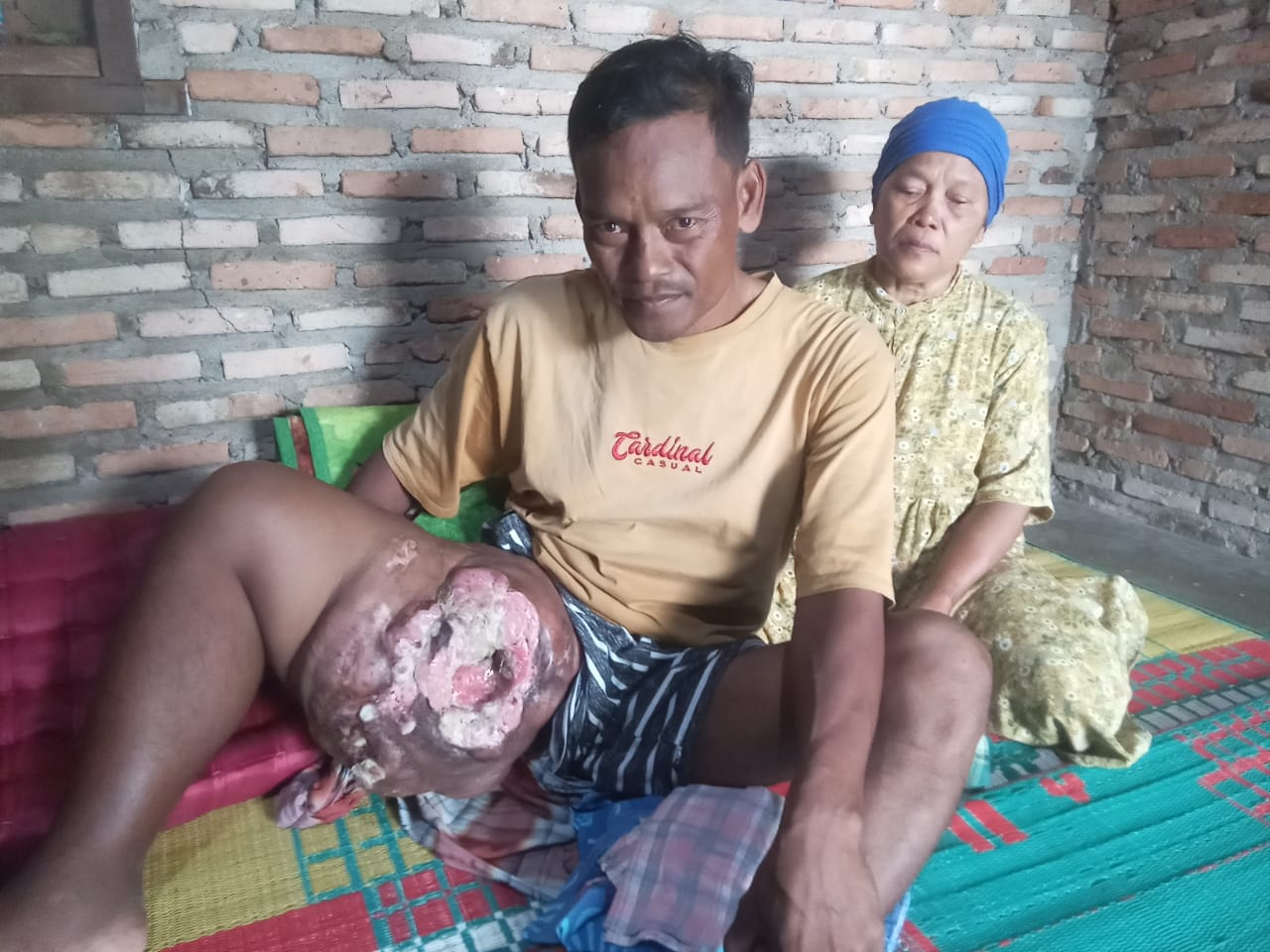Minta Penyakit Tumor Seberat 3 Kg Segera Dioperasi, Rudi Nainggolan Minta Uluran Tangan Bupati Asahan